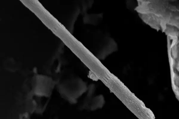 bacterium under the microscope